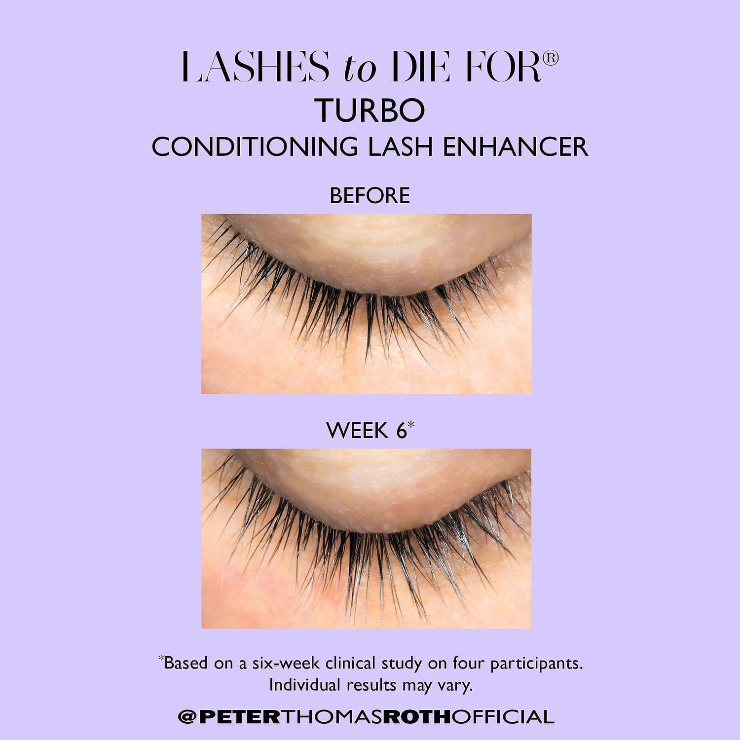 PETER THOMAS ROTH Lashes to Die For® Turbo Conditioning Lash Enhancer