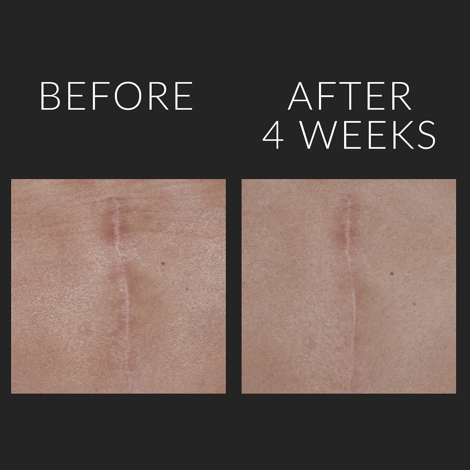 KATE SOMERVILLE D-Scar™ Scar Diminishing Serum