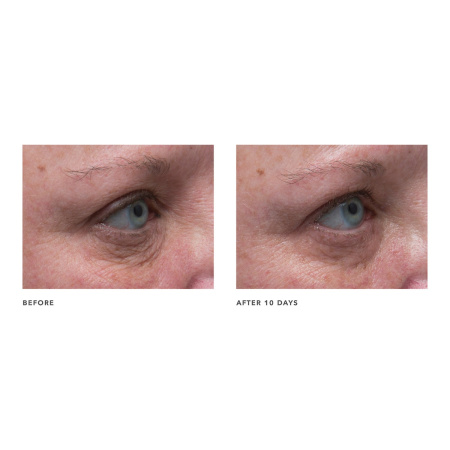 ALGENIST ELEVATE Firming & Lifting Contouring Eye Cream купить в Beauty Storage. Быстрая доставка по России и СНГ.