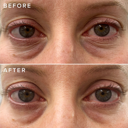 FARMACY Cheer Up Brightening Vitamin C Eye Cream with Acerola Cherry купить в Beauty Storage. Быстрая доставка по России и СНГ.
