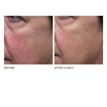 DR. DENNIS GROSS SKINCARE Vitamin C+ Collagen Deep Cream