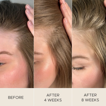 Купить CHRISTOPHE ROBIN Fortifying Scalp Serum на Beautystorage.ru. Быстрая доставка по России и СНГ.
