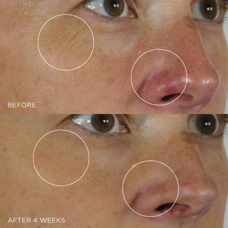TATCHA The Silk Serum Wrinkle-Smoothing Retinol Alternative купить в Beauty Storage. Быстрая доставка по России и СНГ.
