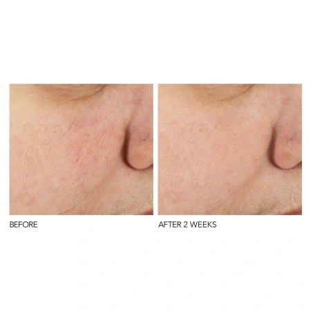 DR. DENNIS GROSS B₃Adaptive SuperFoods™ Stress Repair Face Cream купить в Beauty Storage. Быстрая доставка по России и СНГ.