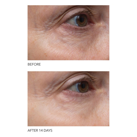 DR. DENNIS GROSS SKINCARE Vitamin C+ Collagen Brighten & Firm Eye Cream
