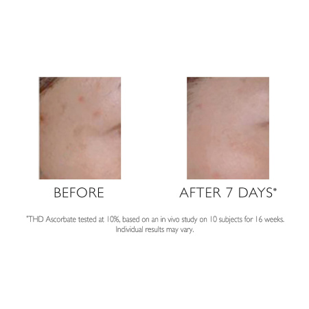 PETER THOMAS ROTH Potent-C™ Vitamin C Targeted Spot Brightener