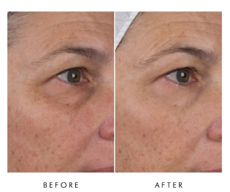 ALPHA-H Liquid Gold Firming Eye Cream