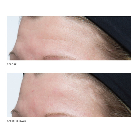 ALGENIST GENIUS Ultimate Anti-Aging Cream купить в Beauty Storage. Быстрая доставка по России и СНГ.