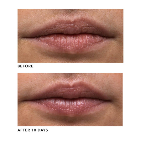 ALGENIST GENIUS Liquid Collagen Lip Treatment купить в Beauty Storage. Быстрая доставка по России и СНГ.
