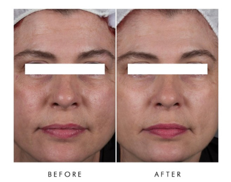 ALPHA-H Liquid Gold Ultimate Perfecting Mask