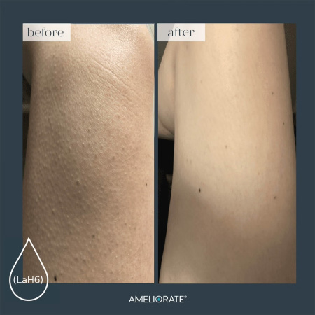 AMELIORATE Transforming Body Lotion купить в Beauty Storage. Быстрая доставка по России и СНГ.
