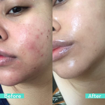 HUM NUTRITION Daily Cleanse Clear Skin and Body Detox Supplement купить в Beauty Storage. Быстрая доставка по России и СНГ.