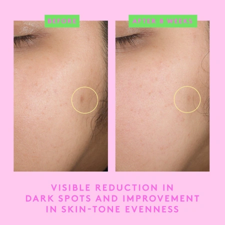 DRUNK ELEPHANT B-Goldi™ Bright Illuminating Drops with 5% Niacinamide купить в Beauty Storage. Быстрая доставка по России и СНГ.
