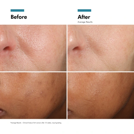 Купить SKINCEUTICALS Discoloration Defense Corrective Serum на Beautystorage.ru. Быстрая доставка по России и СНГ.