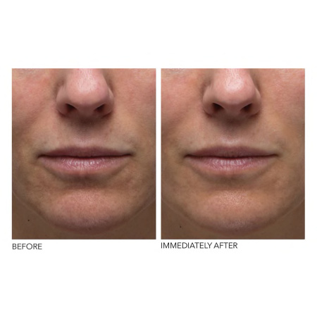 DR. DENNIS GROSS SKINCARE Hyaluronic Marine Hydrating Modeling Mask