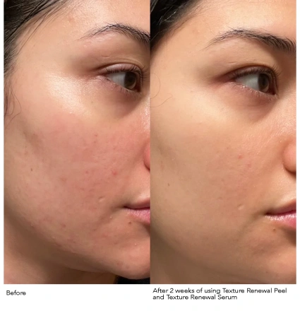 DR. DENNIS GROSS Advanced Retinol + Ferulic Texture Renewal Serum купить в Beauty Storage. Быстрая доставка по России и СНГ.