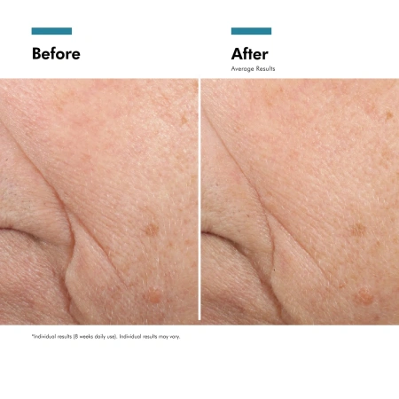 Купить SKINCEUTICALS Triple Lipid Restore 2:4:2 Anti-Ageing Cream for Dry Skin на Beautystorage.ru. Быстрая доставка по России и СНГ.