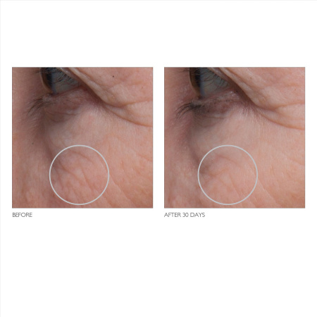 KATE SOMERVILLE Tight'N™ Cryogenic Tightening Gel