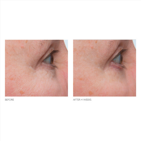 KATE SOMERVILLE Retinol Firming Eye Cream