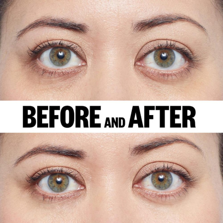 PEACE OUT Puffy Under-Eye Patches