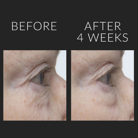 KATE SOMERVILLE Wrinkle Warrior™ 2-in-1 Plumping Moisturizer + Serum