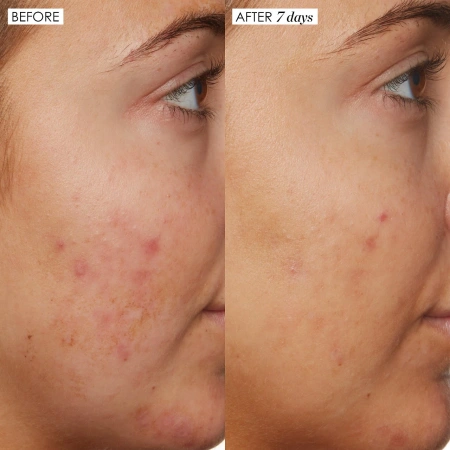 SUNDAY RILEY B3 Nice 10% Niacinamide Serum купить в Beauty Storage. Быстрая доставка по России и СНГ.