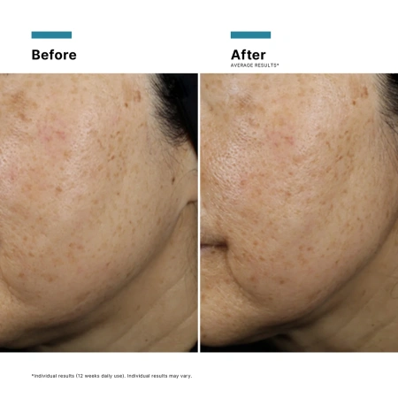 Купить SKINCEUTICALS A.G.E. Interrupter Ultra Serum на Beautystorage.ru. Быстрая доставка по России и СНГ.