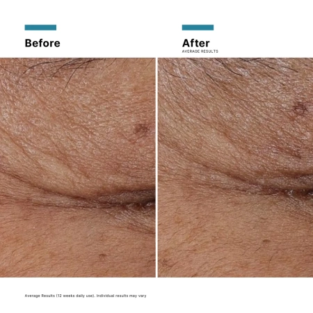 Купить SKINCEUTICALS P-Tiox Neuro-Peptide Serum на Beautystorage.ru. Быстрая доставка по России и СНГ.