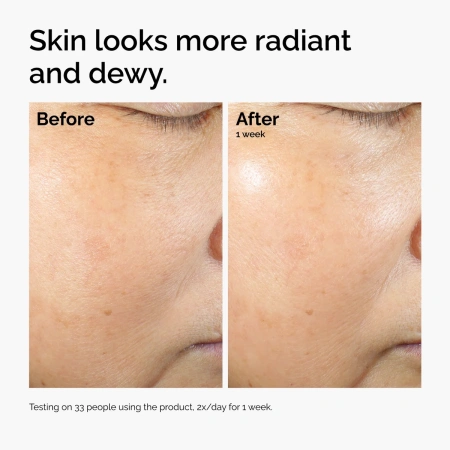 Купить THE ORDINARY Rice Lipids + Ectoin Microemulsion Ultra-Light Moisturiser на Beautystorage.ru. Быстрая доставка по России и СНГ.