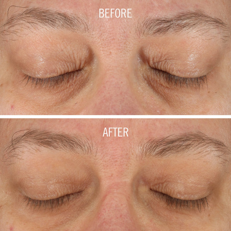 FIRST AID BEAUTY FAB Skin Lab Retinol Eye Cream with Triple Hyaluronic Acid