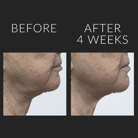 KATE SOMERVILLE Wrinkle Warrior™ 2-in-1 Plumping Moisturizer + Serum