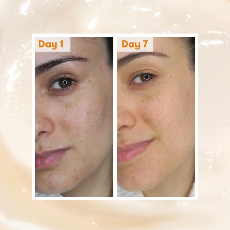 REN Clean Skincare Overnight Glow Dark Spot Sleeping Cream купить в Beauty Storage. Быстрая доставка по России и СНГ.