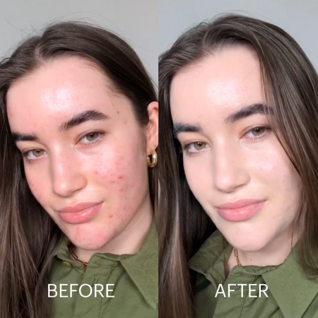 DR. JART+ Cicapair™ Tiger Grass Color Correcting Treatment SPF 30 купить в Beauty Storage. Быстрая доставка по России и СНГ.
