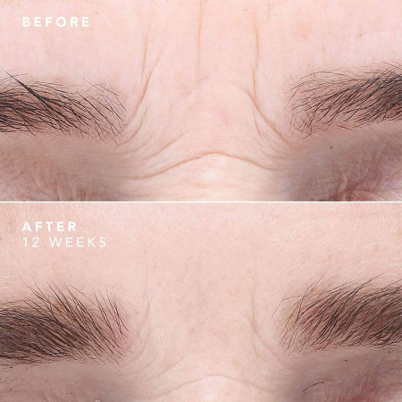 BIOEFFECT EGF Serum купить в Beauty Storage. Быстрая доставка по России и СНГ.
