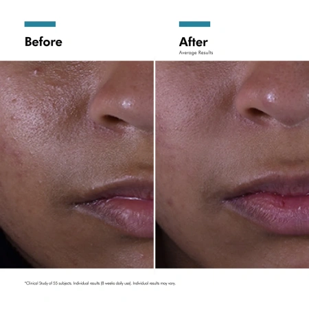 Купить SKINCEUTICALS Silymarin CF Vitamin C Salicylic Acid Antioxidant Serum на Beautystorage.ru. Быстрая доставка по России и СНГ.