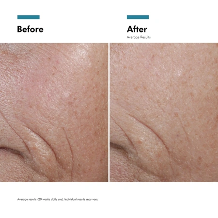 Купить SKINCEUTICALS C E Ferulic Antioxidant Vitamin C Serum for Normal and Dry Skin на Beautystorage.ru. Быстрая доставка по России и СНГ.
