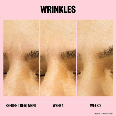 PEACE OUT Microneedling Anti-Wrinkle Retinol Patches