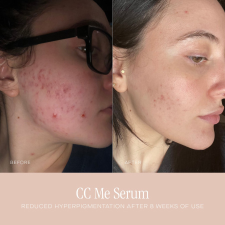 SUMMER FRIDAYS CC Me Vitamin C Serum