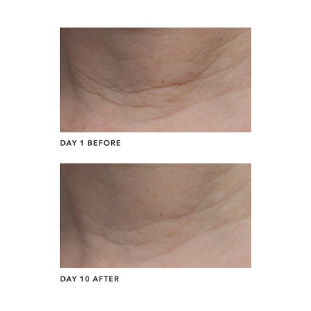 ALGENIST Firming & Lifting Neck Cream купить в Beauty Storage. Быстрая доставка по России и СНГ.
