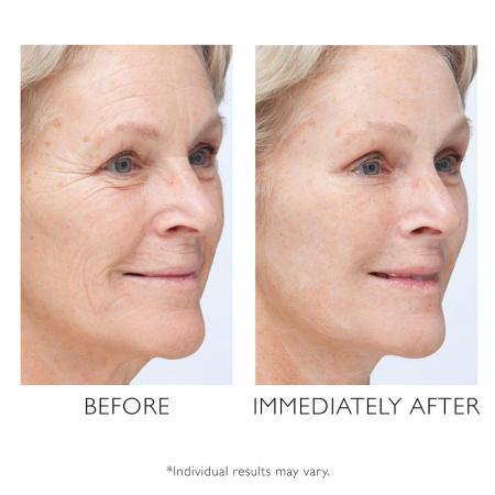 PETER THOMAS ROTH Instant Firmx™